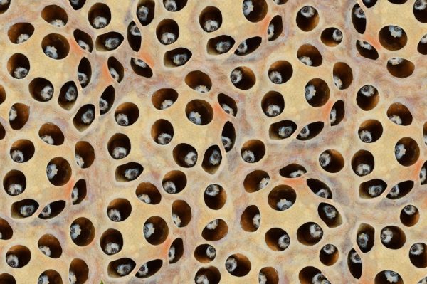 What is Trypophobia?- Fear of Holes! Symptoms, Causes And Treatment