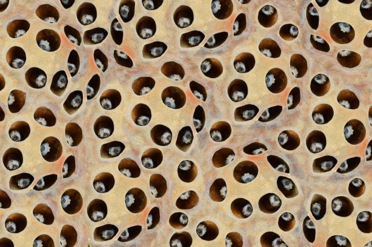 What Is Trypophobia?- Fear Of Holes! Symptoms, Causes And Treatment