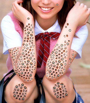 What is Trypophobia?- A Fear of Holes! Symptoms, Causes And Treatment